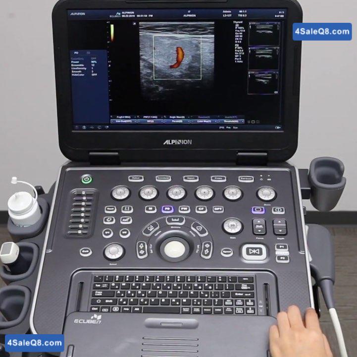 diagnostics ultrasound 
