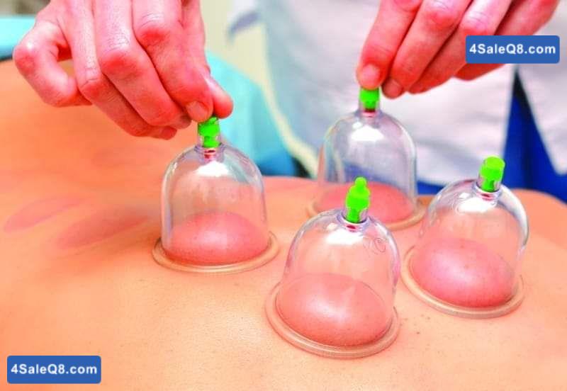 Cupping Theraphy... الحجامة